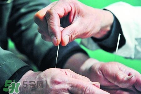 沒病可以針灸嗎？沒病可以扎針嗎？