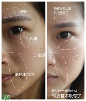 赫拉氣墊用了悶痘嗎？赫拉氣墊悶痘怎么辦？