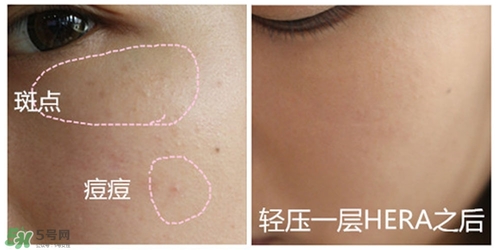 赫拉氣墊用了悶痘嗎？赫拉氣墊悶痘怎么辦？