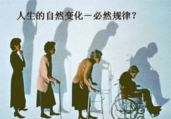 哪些人容易得骨質(zhì)疏松癥？骨質(zhì)疏松的高發(fā)人群有哪些？