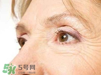 老年斑是怎么形成的？老年斑的形成原因