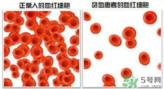 缺鐵性貧血的癥狀 缺鐵性貧血的癥狀有哪些？