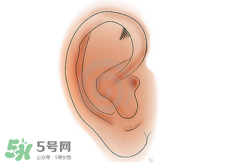 中耳炎有什么癥狀？中耳炎的癥狀表現(xiàn)