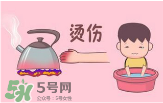 燙傷可以用牙膏嗎？燙傷用牙膏管用嗎？