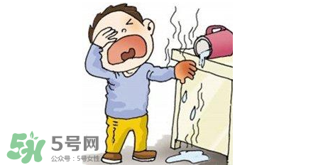 燙傷可以用牙膏嗎？燙傷用牙膏管用嗎？