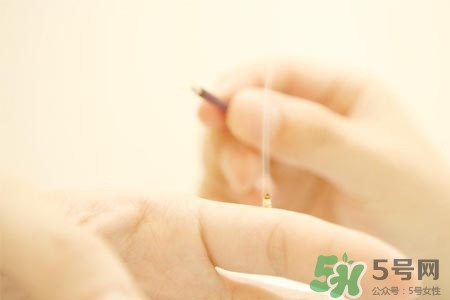 艾灸可以減肥嗎？艾灸減肥的穴位方法介紹