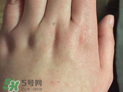 薇諾娜適合什么皮膚？薇諾娜適合敏感肌嗎？