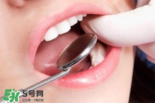 口腔異味是怎么回事？口腔異味怎么清除？