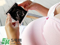 保胎期間可以洗澡嗎？臥床保胎可以洗澡嗎？