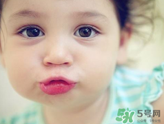 孕期可以激光祛斑嗎？懷孕了能做激光祛斑嗎？