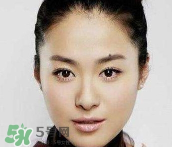 如何預(yù)防臉上長(zhǎng)痣？怎樣預(yù)防臉上長(zhǎng)痣