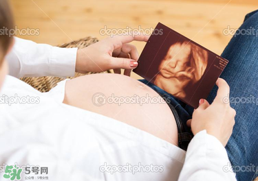 橄欖油真的可以預(yù)防妊娠紋嗎？橄欖油真的可以去妊娠紋嗎？