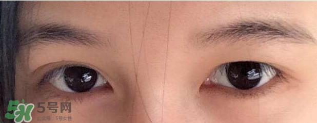 眼睛發(fā)黃是怎么回事？眼睛發(fā)黃是什么原因