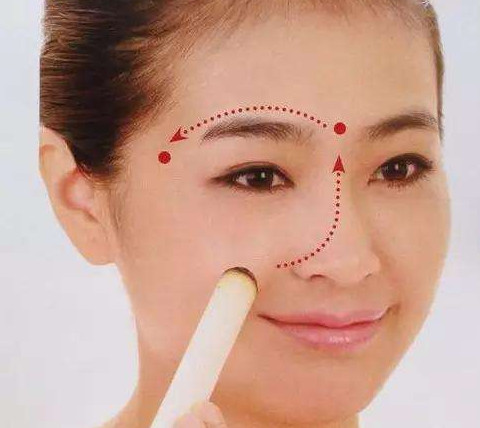 艾灸可以去黑眼圈嗎？艾灸可不可以去黑眼圈