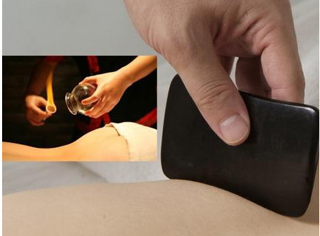 刮痧之后可以拔罐嗎？刮痧之后可不可以拔罐