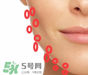 nuface美容儀有效嗎？nuface美容儀副作用？