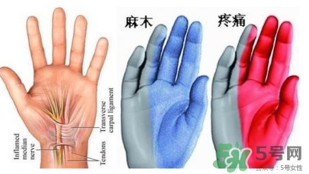 手腳發(fā)麻是缺鈣嗎？手腳發(fā)麻是不是缺鈣