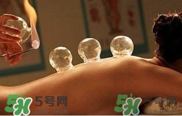 拔火罐疼嗎？拔火罐疼不疼