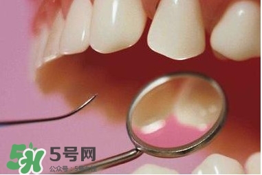 牙周炎傳染嗎？牙周炎會不會傳染