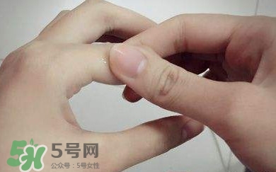 痛風有什么癥狀？女性痛風的初期癥狀