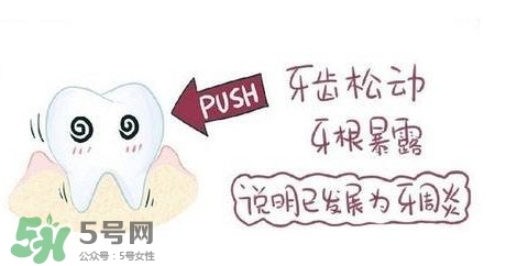 牙齒松動能自己恢復(fù)嗎？牙齒松動會自己恢復(fù)嗎