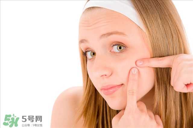 得了痤瘡飲食注意什么？有痤瘡吃東西注意什么