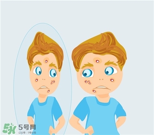 得了痤瘡飲食注意什么？有痤瘡吃東西注意什么