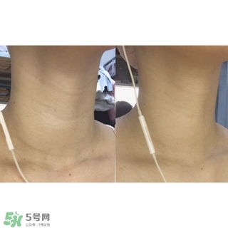 悅薇適合什么年齡？資生堂悅薇適合年齡段