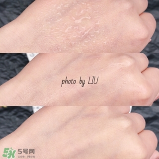 美帕b5噴霧有激素嗎？美帕噴霧副作用