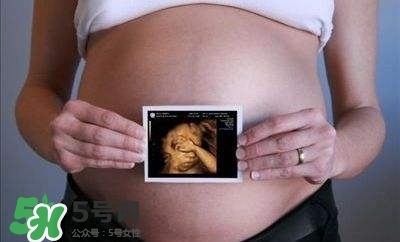 四維彩超能看出男女嗎？四維彩超能看清手指嗎？