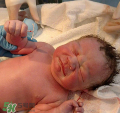 新生兒手握避孕環(huán)出生是怎么回事？出生后健康嗎？