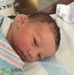 新生兒手握避孕環(huán)出生是怎么回事？出生后健康嗎？