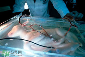 人造子宮能生孩子嗎？人造子宮成功案例