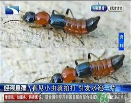 隱翅蟲有毒嗎？隱翅蟲會(huì)毀容嗎？