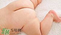 尿布疹怎么辦？寶寶尿布疹擦什么藥好？