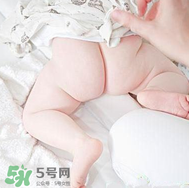 尿布疹和濕疹的區(qū)別 尿布疹和濕疹如何區(qū)分？