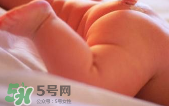 寶寶尿布疹可以擦紅霉素軟膏嗎？紅霉素軟膏對尿布疹有效嗎？
