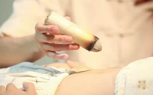 刮痧后可以艾灸嗎？刮痧后注意事項(xiàng)