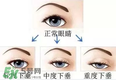 長期用假睫毛雙眼皮貼對眼睛有什么傷害？