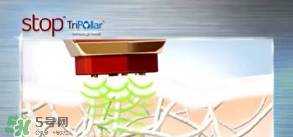 tripollar stop怎么樣？tripollar pose好用嗎