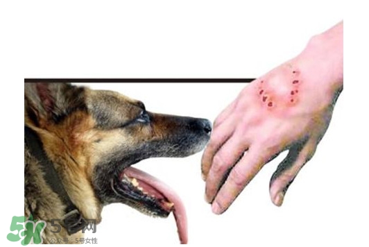 狂犬病會傳染嗎？狂犬病會學(xué)狗叫嗎