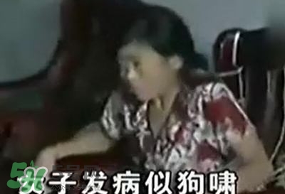 狂犬病能治好嗎？狂犬病的早期癥狀