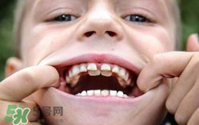 兒童換牙可以吃鈣片嗎?兒童換牙吃什么好？