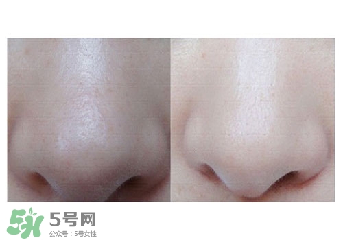 碧柔鼻貼白色和黑色哪個(gè)好？碧柔鼻貼黑白區(qū)別