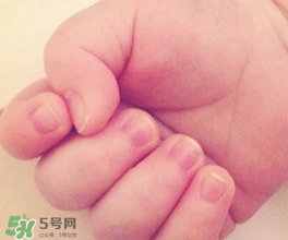 寶寶指甲凹凸不平是什么原因？寶寶指甲凹凸不平正常嗎？