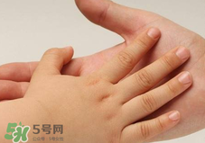 寶寶指甲凹凸不平是什么原因？寶寶指甲凹凸不平正常嗎？