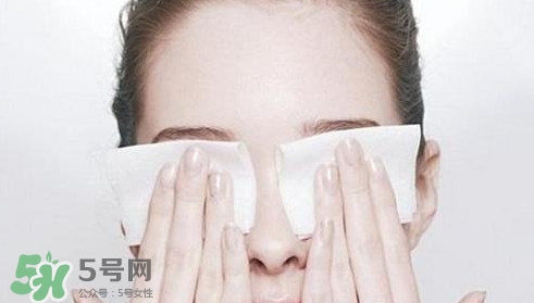 馬鈴薯可以去除黑眼圈嗎？馬鈴薯能去黑眼圈嗎