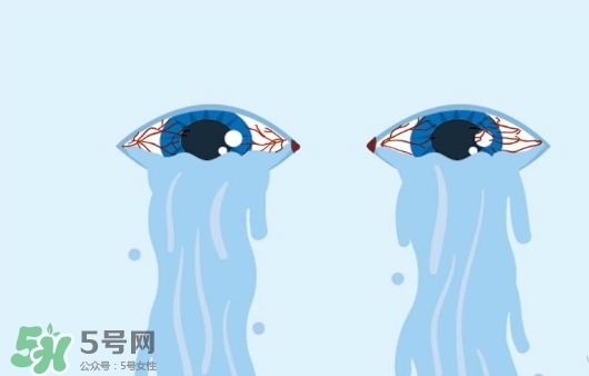 眼藥水可以?xún)蓚€(gè)人用嗎？眼藥水可以共用嗎？