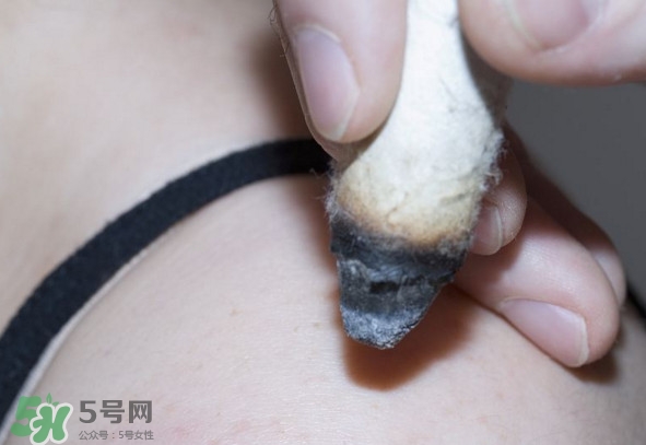 艾灸后為什么會(huì)癢？艾灸后為什么要多喝水