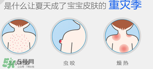 妙思樂爽膚水好用嗎？妙思樂爽膚水能去痱嗎？